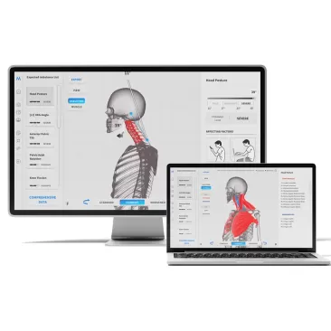 Sistem Analiza Posturala Moti Physio 3D New Mini | Kinetomag