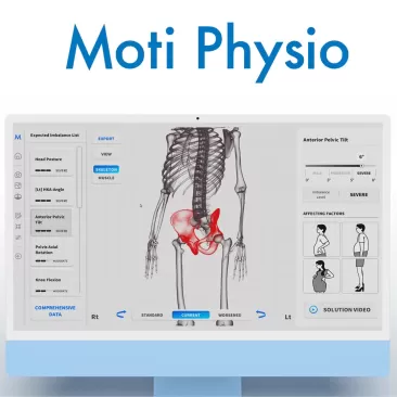Sistem Analiza Posturala Moti Physio 3D New Mini | Kinetomag