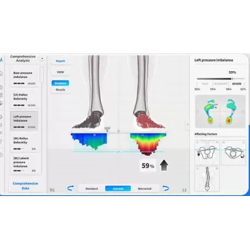Platforma baropodometrica Moti Physio Foot Insight | Kinetomag