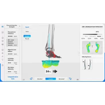 Platforma baropodometrica Moti Physio Foot Insight | Kinetomag
