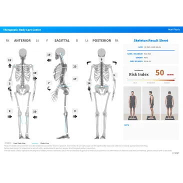 Moti Physio - Sistem Analiza Posturala 3D si Biomecanica